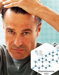Help Banish Baldness